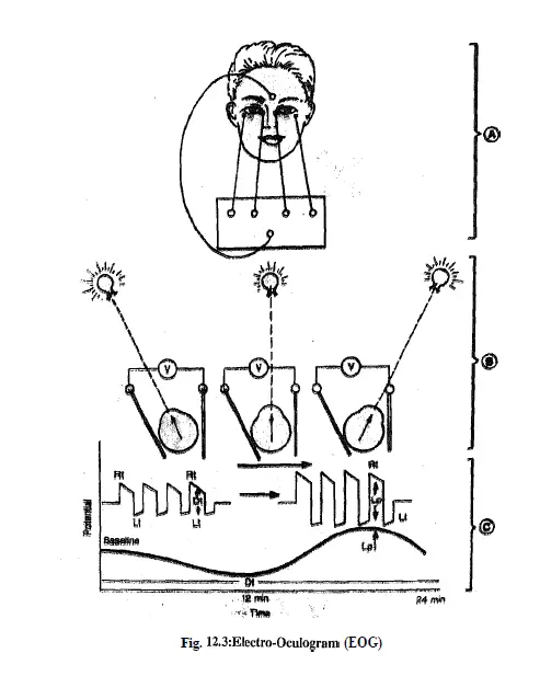 electroretinogram