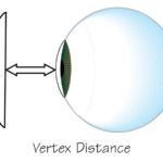 Vertex Distance for Contact Lens
