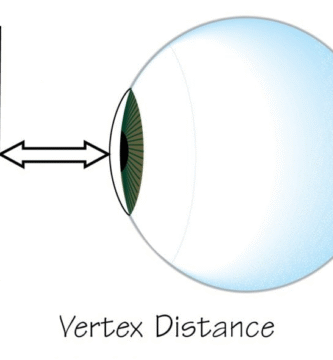 Vertex Distance for Contact Lens
