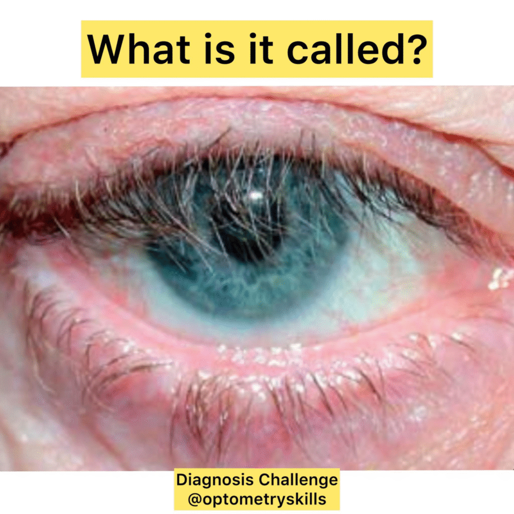 optometry diagnosis challenge