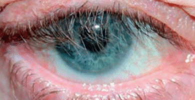 optometry diagnosis challenge