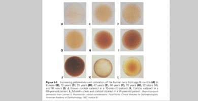 age related lens changes
