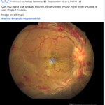 macular star