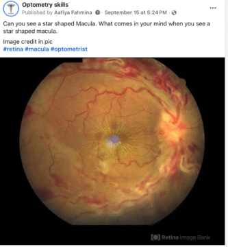macular star