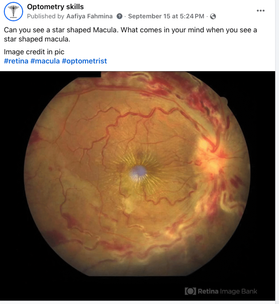 macular star
