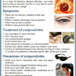 Conjunctivitis- Eye Flu