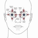 Extra Ocular Muscles Position
