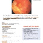Usher Syndrome and Optometry
