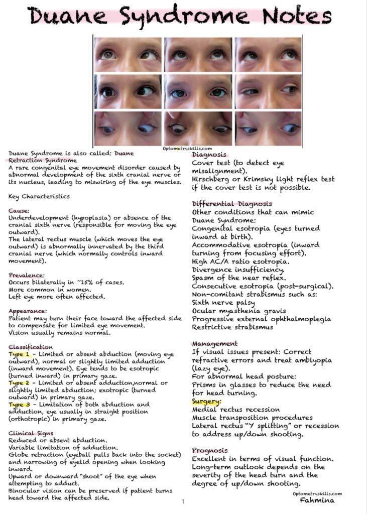 Duane Syndrome Notes