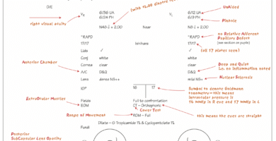 Optometry Clinical Tips: Taking History and Recording the findings