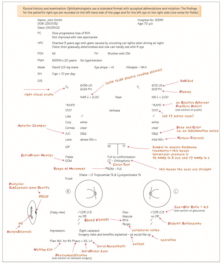 Record History and Examination in Ophthalmology