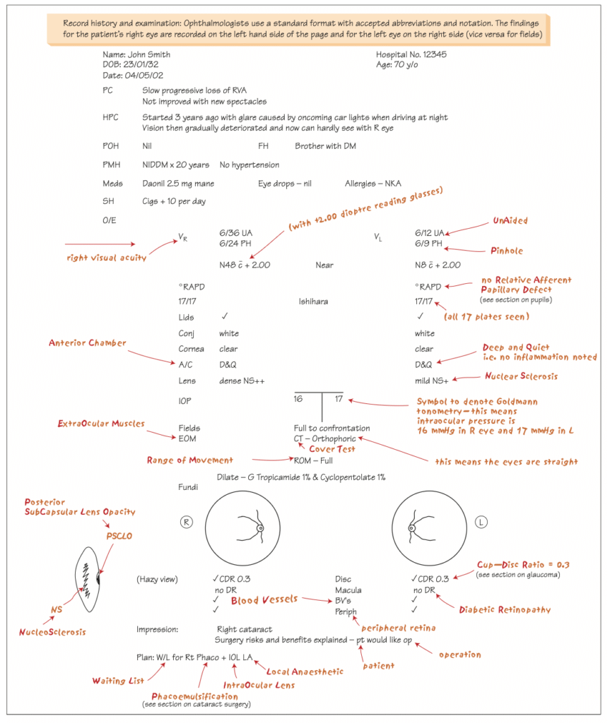 Optometry Clinical Tips: Taking History and Recording the findings