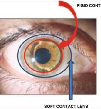 piggybank contact lens