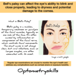 Bell's palsy Awareness Poster