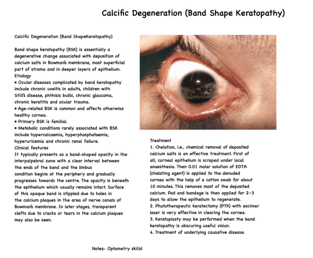 Notes on Band shaped Keratopathy