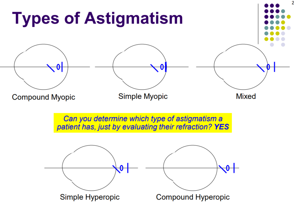 What is Mixed Astigmatism?