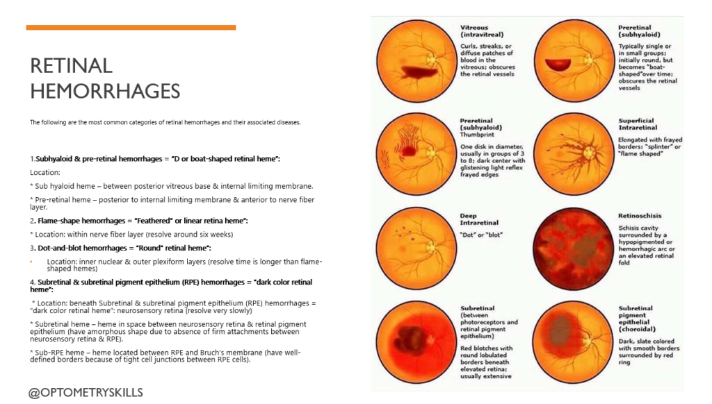 Types of Retinal Hemorrhages and its treatment. 2 image 32