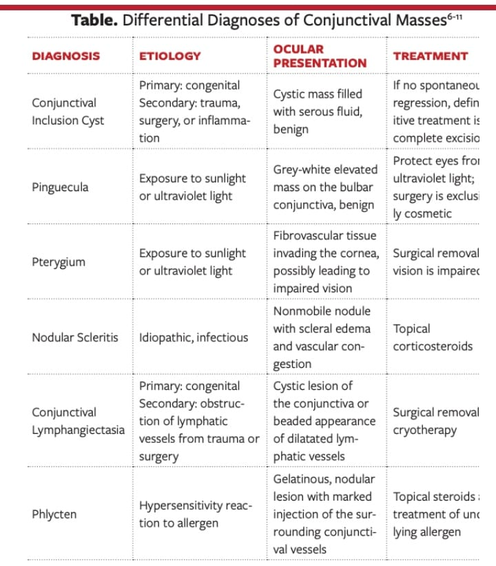 Differential Diagnoses of Conjunctival Masses