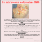 Iris Arteriovenous Malformation