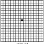 Macular Degeneration Eye Chart Test