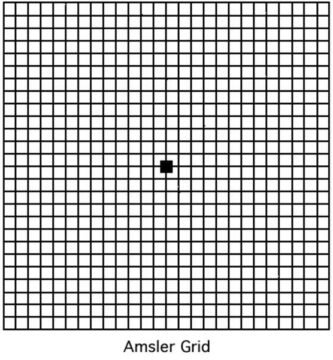 Macular Degeneration Eye Chart Test