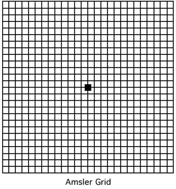 Macular Degeneration Eye Chart Test