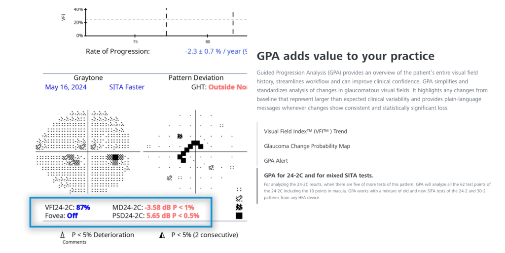 ZEISS Humphrey Field Analyzer 3 