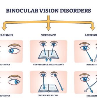 Binocular Vision Disorder, BVD